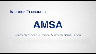 Module: AMSA Anterior Middle Superior Alveolar Injection