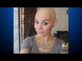 Young Mom Vivian Rae Battles Cancer Again