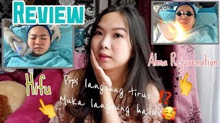 Review HIFU dan ALMA Rejuvenation | Menghilangkan double chin dengan cepat