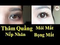 YEN NHI & LIFE | Trị Thâm Quầng Mắt Chỉ Sau 5 Phút Tại Nhà, Trị Thâm Quầng Mắt Hiệu Quả