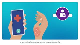 First Aid to help treat burns