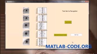 IRIS RECOGNITION USING MATLAB
