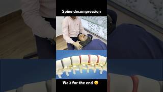 Spine decompression by dr Harish Grover #trend #ytshort #feedshort