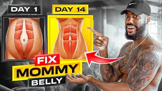 FIX MOMMY BELLY - 2 WEEKS (DO THIS EVERYDAY!)