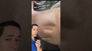 Doctor Reacts: extreme muscle cramps