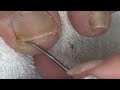 dr. dara toenails treatment. 04