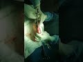 Enterotomy in a dog