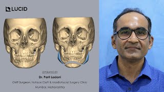 Achieving Masculine Facial Harmony | PEEK Jaw Angle Implants