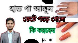 হাত পা আঙ্গুল কেটে পড়ে গেলে অঙ্গহানি এড়ানোর সহজ উপায় | আঙ্গুল  হাত পা কেটে পড়ে গেলে কি করবেন