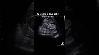 16 weeks 6 days Ultrasound #jerbearimaging #mobilebusiness #privateultrasound #pregnant