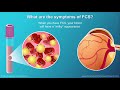 understanding familial chylomicronemia syndrome fcs