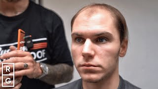 Cutting the COMB-OVER 😱 BALDING Since 19! | Talking Hair Loss S2 EP10