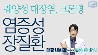 염증성 장질환 - 궤양성 대장염과 크론병, 뭐가 다른가요?