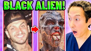 Plastic Surgeon Reacts to BLACK ALIEN PROJECT! Extreme Bodies Explained!
