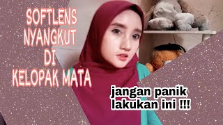 Softlens Tersangkut di Kelopak Mata. Lakukan Ini !!