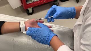 BOTOX for Sweaty Palms | Hyperhidrosis Treatment