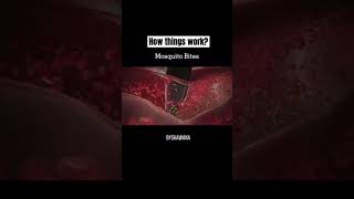 How Things Work | Mosquito Bites #shorts