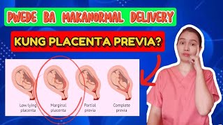 Pwede bang Maka Normal Delivery ang Placenta Previa?(Marginalis)(TAGALOG)