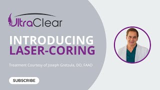 Introducing UltraClear® Laser-Coring