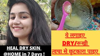 DRY SKIN TREATMENT | DIY for DRY SKIN | HOW TO HEAL DRY DAMAGED SKIN @ HOME | WINTER SKIN CARE