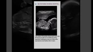 Watch how baby grows 3D Sonography|Dr. Sushila Singh Kaikade #dombivali