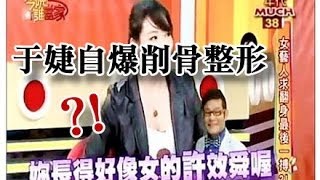 于婕自爆曾削骨改變臉型！ 教主醫美整形診所 郭菁松醫師