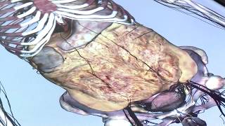 The Digestive System