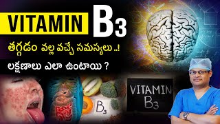 Vitamin B3 deficiency | Niacin | What happens if vitamin B3 is low | Vitamin B3 | Dr GPV Subbaiah