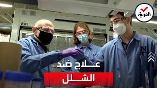 باحثون يطورون علاجا يعزز التعافي من الشلل