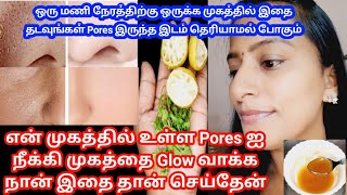 என் முகத்தில் உள்ள பள்ளம் போக இதை மட்டும் தான் செய்தேன் | How to close large poem pores in 3 days