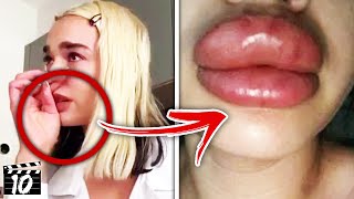 Top 10 Celebrities Who Went WAY Too Far With Plastic Surgery