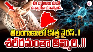 తెలంగాణకు కొత్త వైరస్..!! లక్షణాలు ఇవే | GBS Virus | GBS symptoms | SumanTV Annamayya Dist