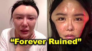 China's "Bubble Face" Trend Is Destroying Lives