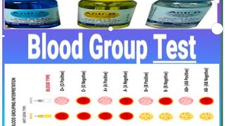 BLOOD GROUP TEST, POSATIVE & NEGATIVE Blood group,