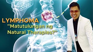 LYMPHOMA - bukol sa leeg matutulungan ng Natural Therapies?