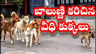 #news సంగారెడ్డి జిల్లా, పట్టణంలోని 12వ వార్డులో పసి పిల్లవాడి పై వీధి కుక్కల అటాక్.