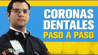 👑 🦷Como se hace una corona dental❓ Todo lo que debes saber 👑 🦷 Procedimiento para CORONAS DENTALES