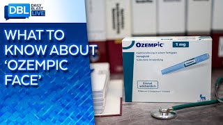 'Ozempic Face:' Some Users Report Aged, Exhausted Look After Using Drug