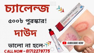 দাউদের সবচেয়ে ভালো ঔষধ ডেরোবিন || দাউদ এর ঔষধ  Derobin || डेरोबिन क्रीम किस काम में आता है || দাদ