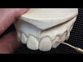 dental wax up teeth 21 23 part 1 of 2 comprehensive waxup tutorial