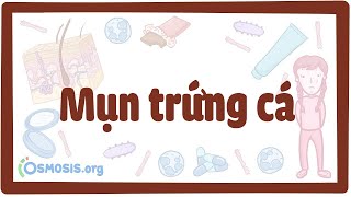 Mụn trứng cá