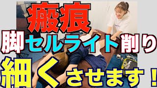 小顔脚やせ　脚を細くする施術　セルライトケア　エステでは出来ない骨削り　瘢痕脚セルライト削り　施術の様子です