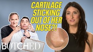 Edra's BOTCHED Nose Has Cartilage Sticking Out of the Tip?! (BEFORE & AFTER) | Botched | E!