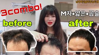 [헤어/menshair]극강의 곱슬+얇은머리+넓은이마(M자이마)커버하는 남자볼륨매직+루트펌 by남자머리살려주는티샘