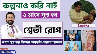 মাত্র ১ মাসেই শ্বেতী রোগ থেকে সম্পুর্ন সুস্থ।  ACRH | Dr Haque