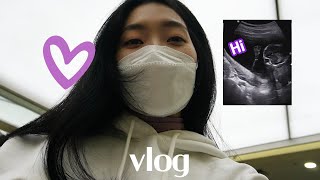 vlog 임신 16-17주 | 수수 성별 공개 | 사랑하는 가족들과 보낸 주