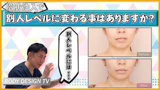 ［激変以上、別人未満］顔の脂肪注入で周りが認識できない程に人相変わることはある？｜vol.470【ボディデザインTV】