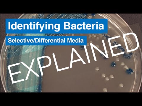 What are examples of selective media?