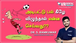 அடிபட்டு பல் கீழே விழுந்தால் என்ன செய்வது?? What To Do If A Permanent Tooth Falls Out?? Dr RAMKUMAR