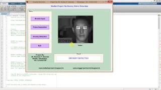 Drowsy Driver Detection Using Matlab Source Code FINAL YEAR PROJECT